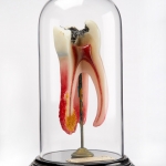 Dental Display